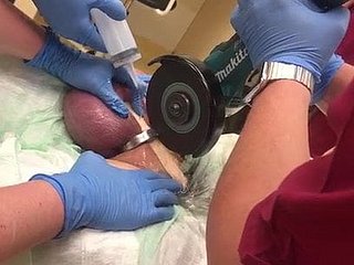 どのようにしないAコックリングを削除するには！