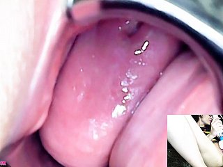 Adalynnx - Endoscope spéculum vibrateur hitachi sperme